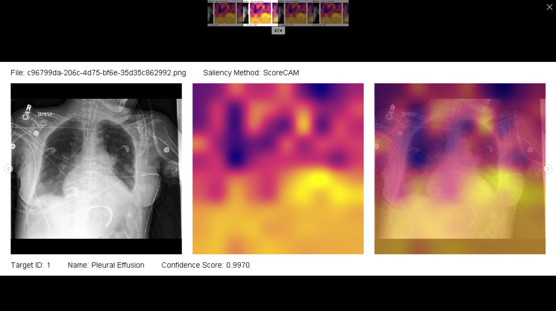 Heatmap visualization for pleural effusion classification