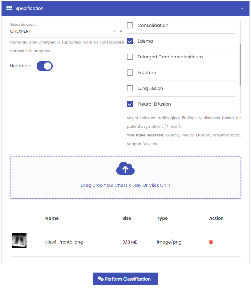 X-Ray classification using CheXpert Dataset