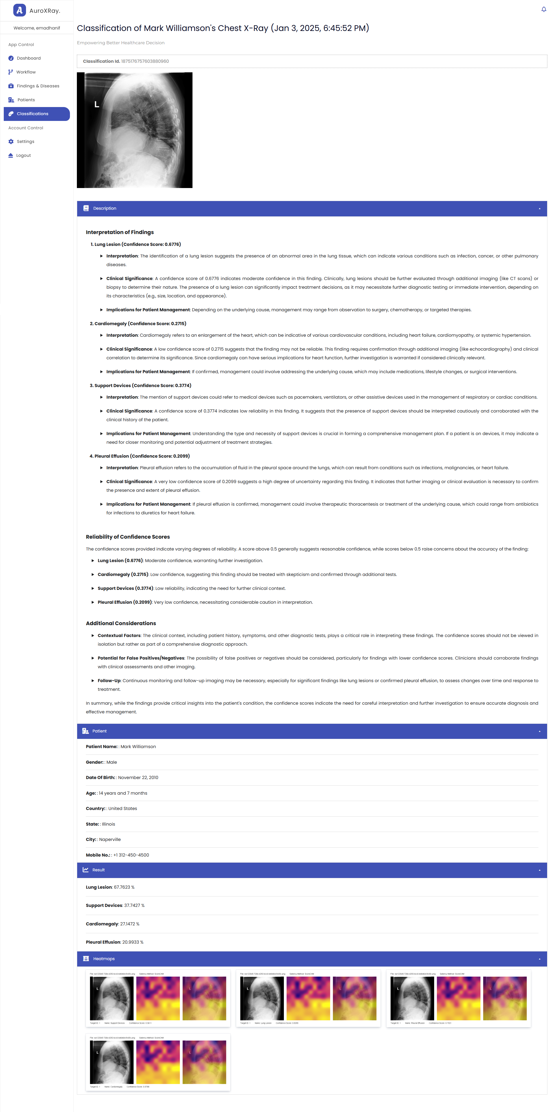 AuroXRay X-ray classification results with LLM explanation and heatmap